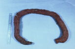 bandeau, image 2/2