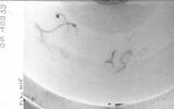 Petit vase Fontanieu, d'une garniture (OA 10939 à OA 10941), image 5/7