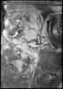 Trésor de Boscoreale : skyphos, image 11/19