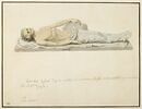 Les restes de Louis XV, exhumés de son tombeau en 1793, image 1/2